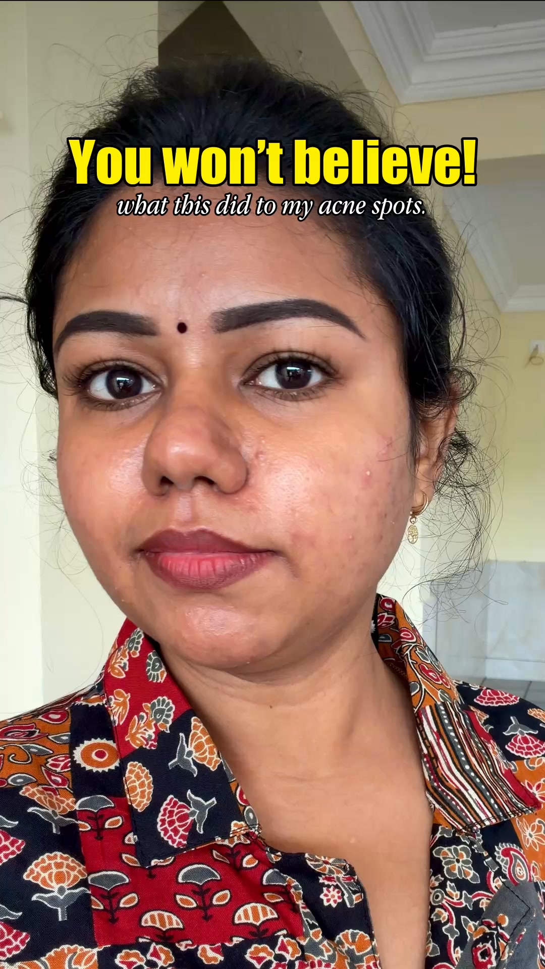 Watch The Serum Work On Nithya’s Skin