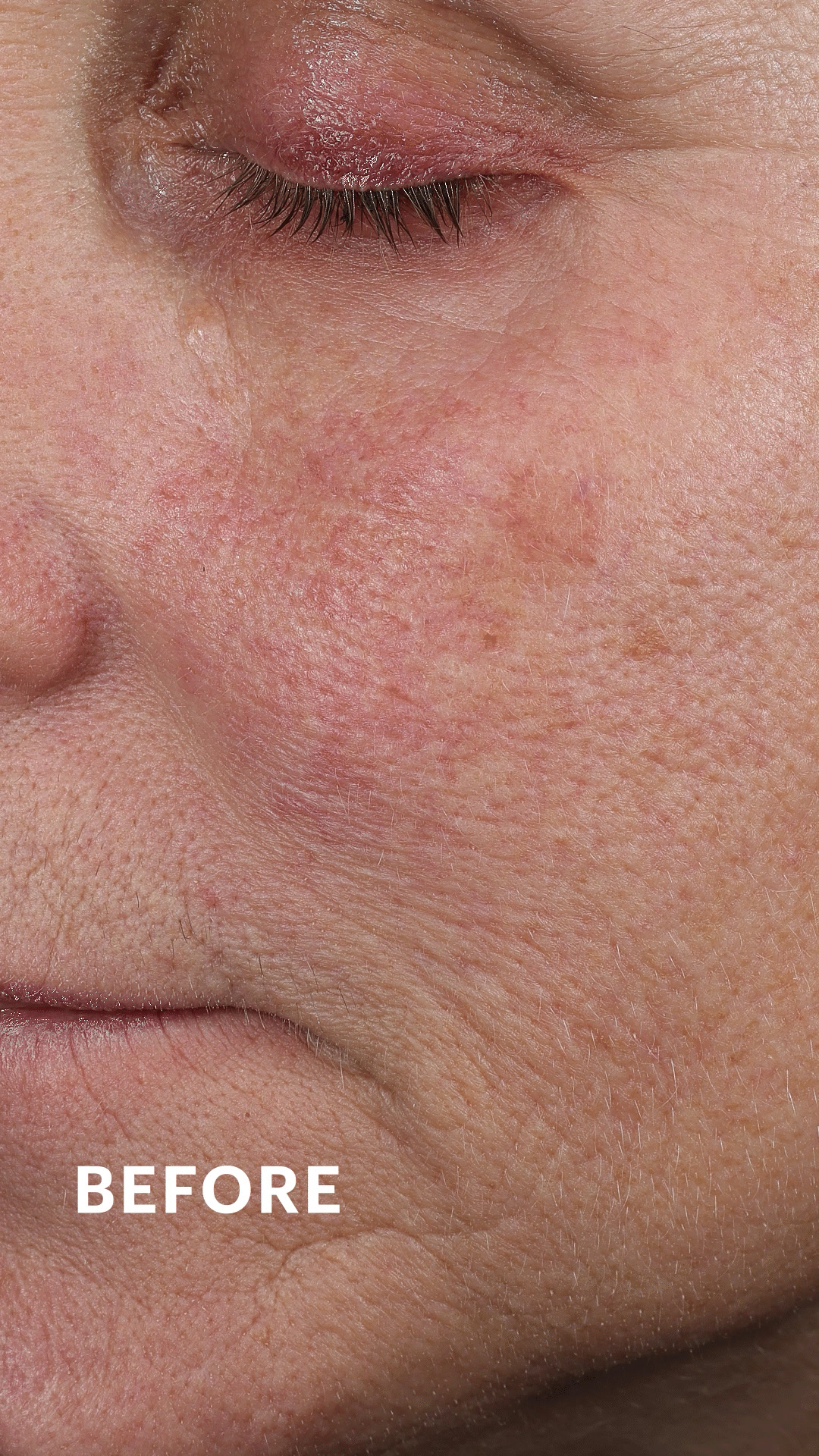 Collagen-Boosting Growth Factor Cream