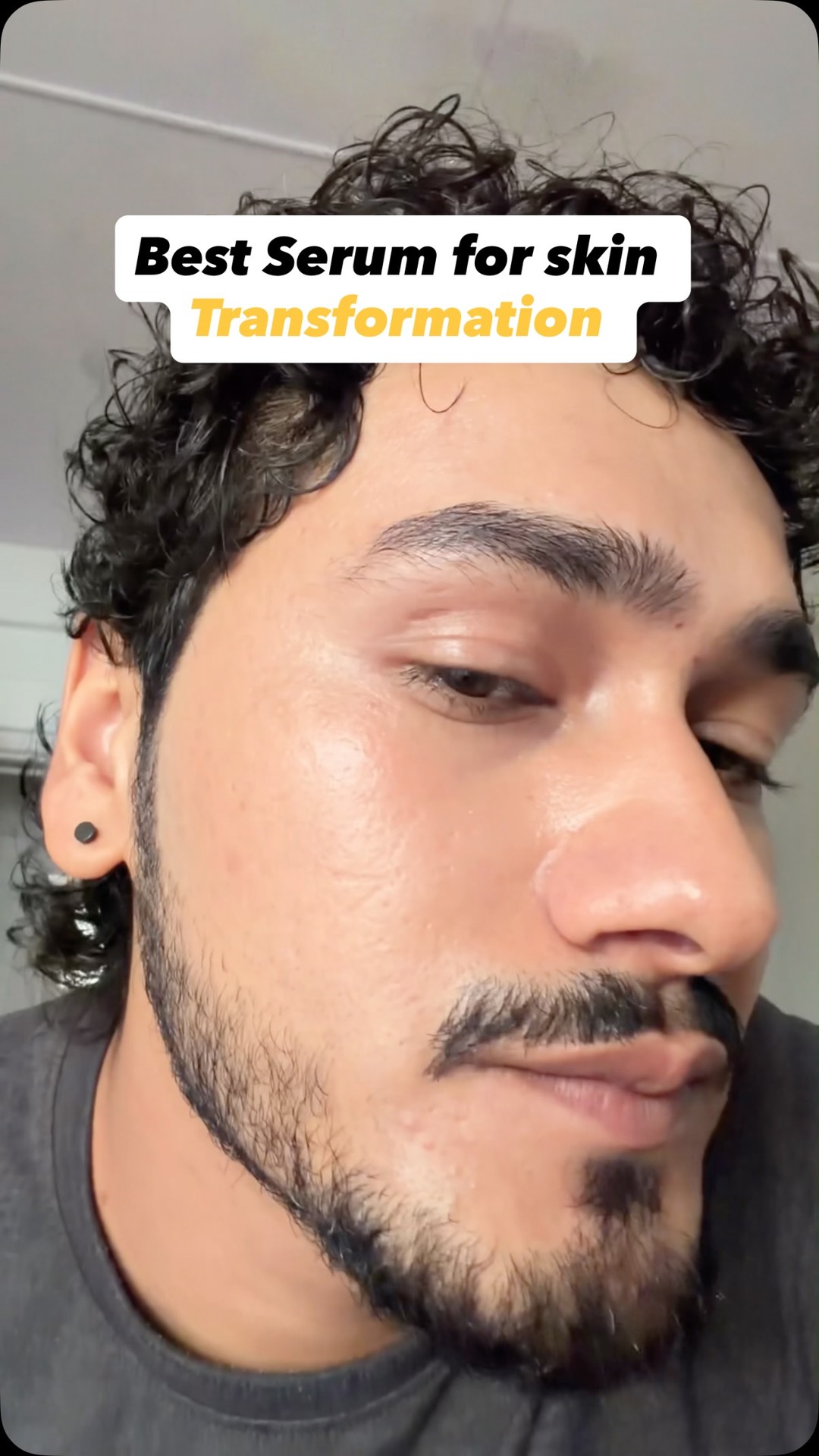 Comment “teen” for 🔗

this serum has some powerful ingredients like Glutathione and Vitamin C and they are remarkable in skin Transformation..use it regularly for good results 
@foxtaleskin 

{skincaretips, skin Transfor