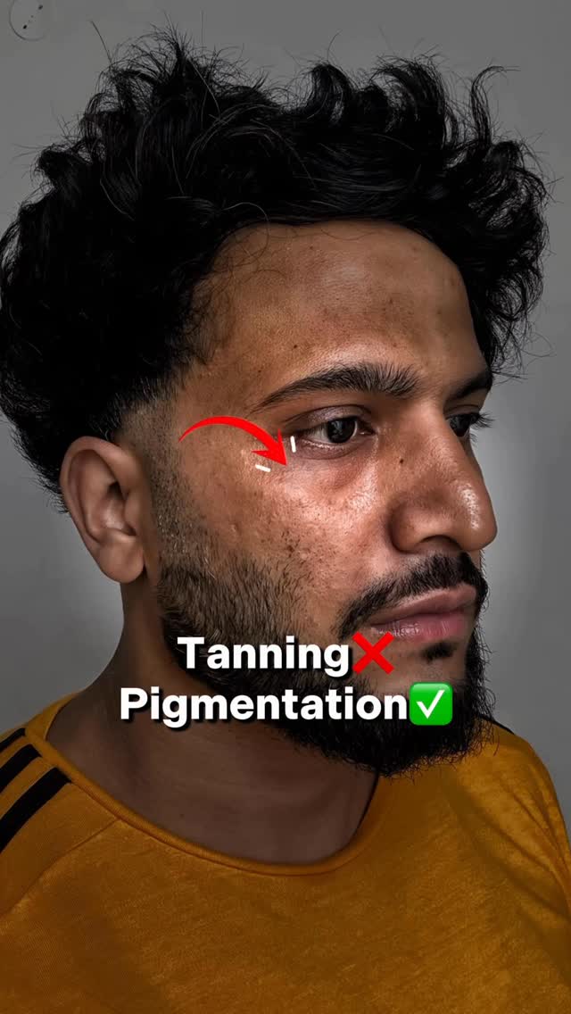 Save & share for later
Comment “Link” for links
Remove Pigmentation at Home
#skincare yudi0016