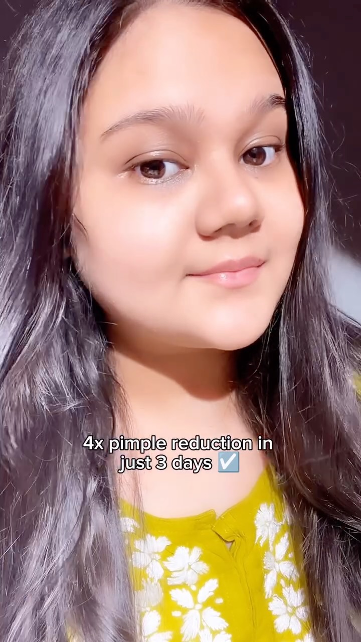 Comment for link 🔗✨ @mamaearth.in 
.
.
skincare skincareroutine acneprone acnetreatment pimplesolution oilyskin combatskin clearingskin glowingskin healthyskin facewash skincareproducts teatree salicylicacid dermaskincar