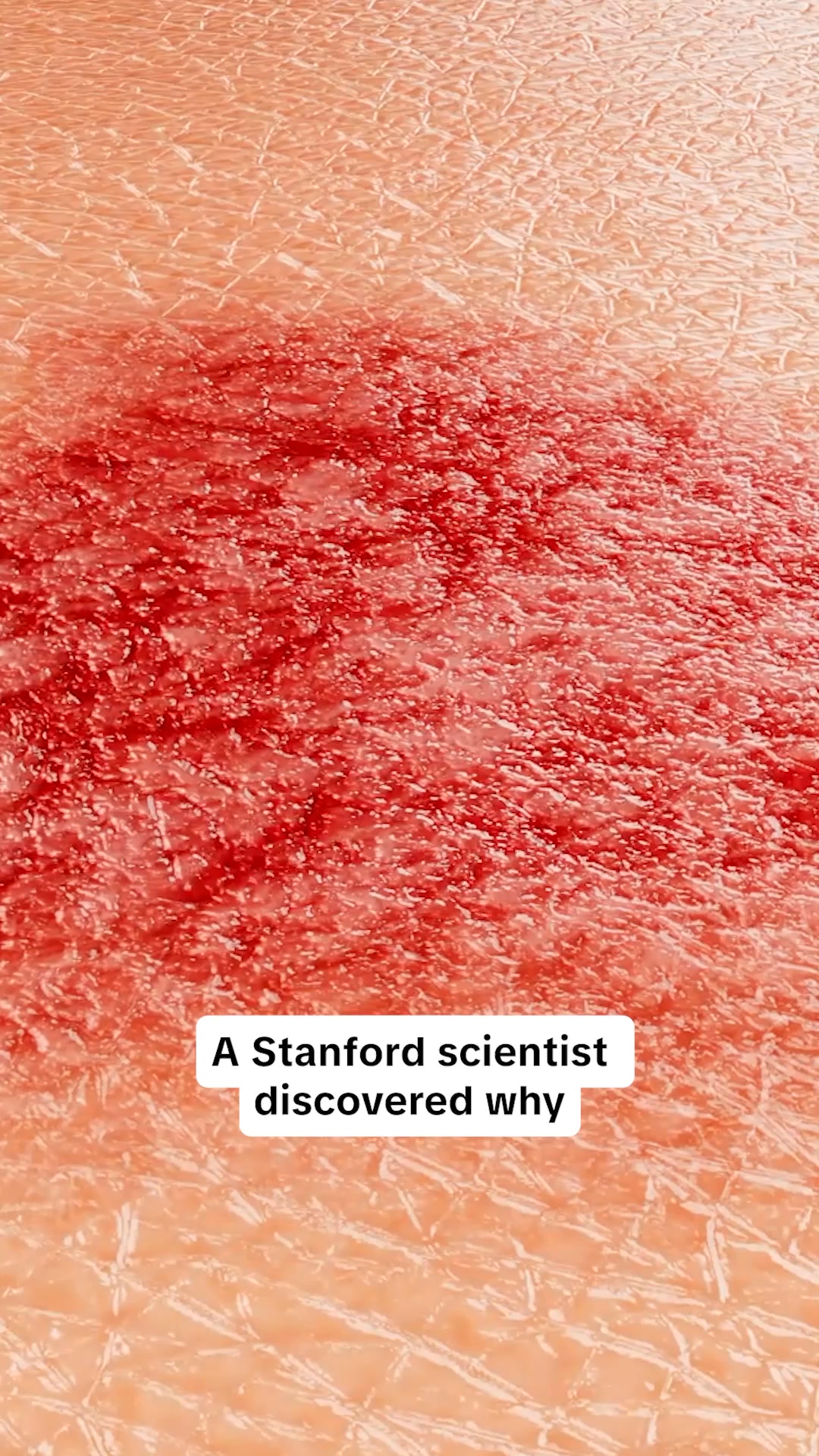 Calmer skin. Fewer flares.