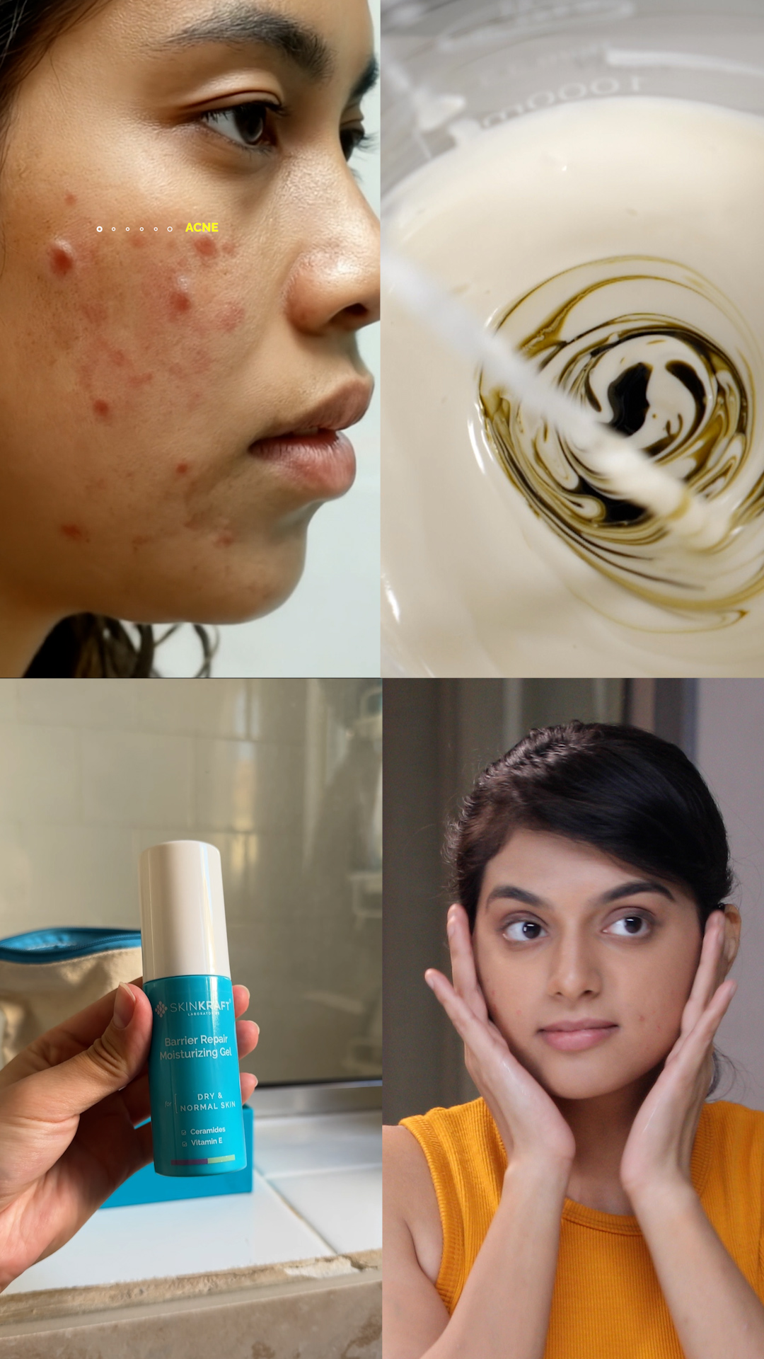 SkinKraft - India's Only Customized Skin Care Regimen