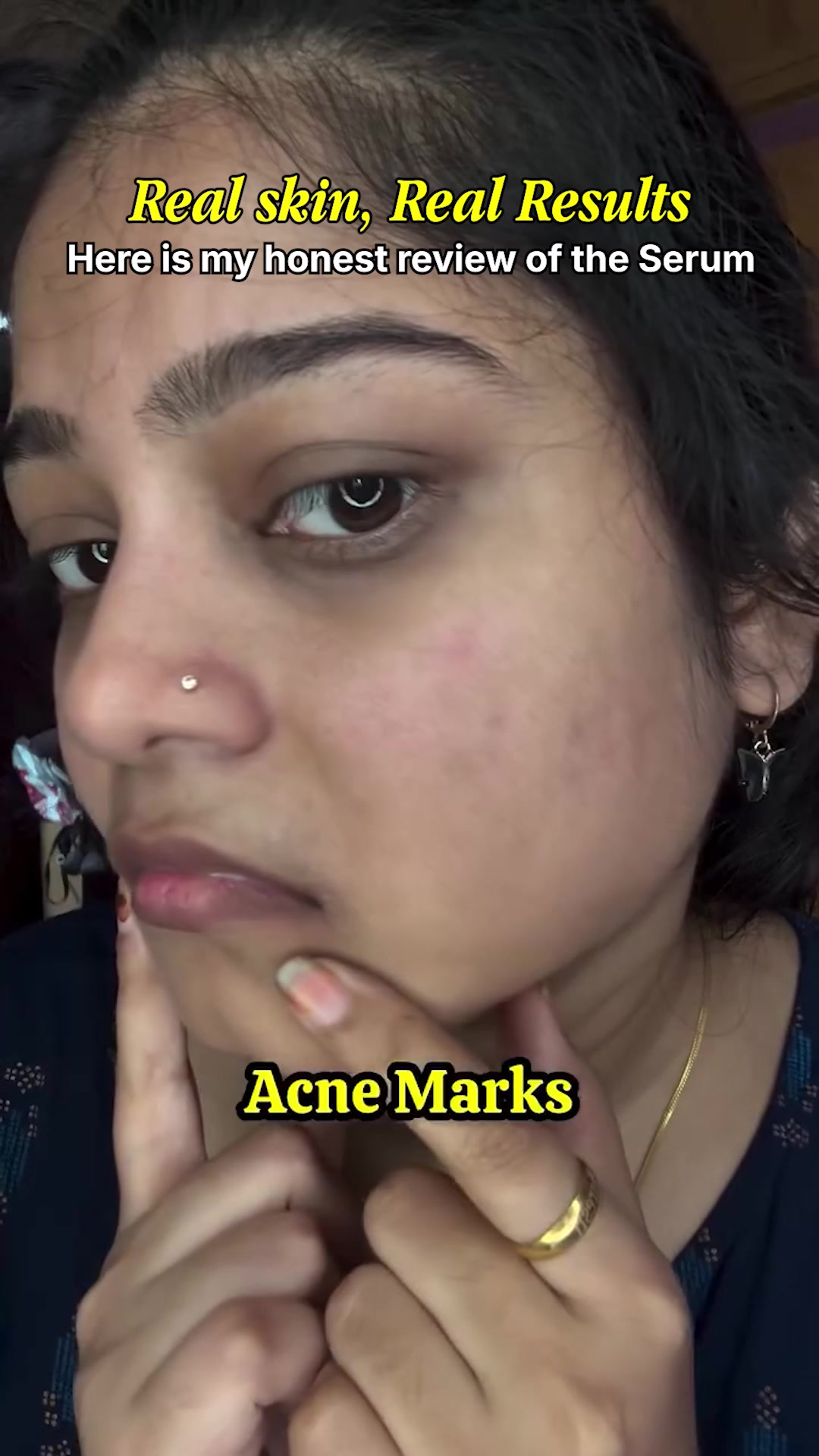 Plant-Based Formula For Brighter Skin