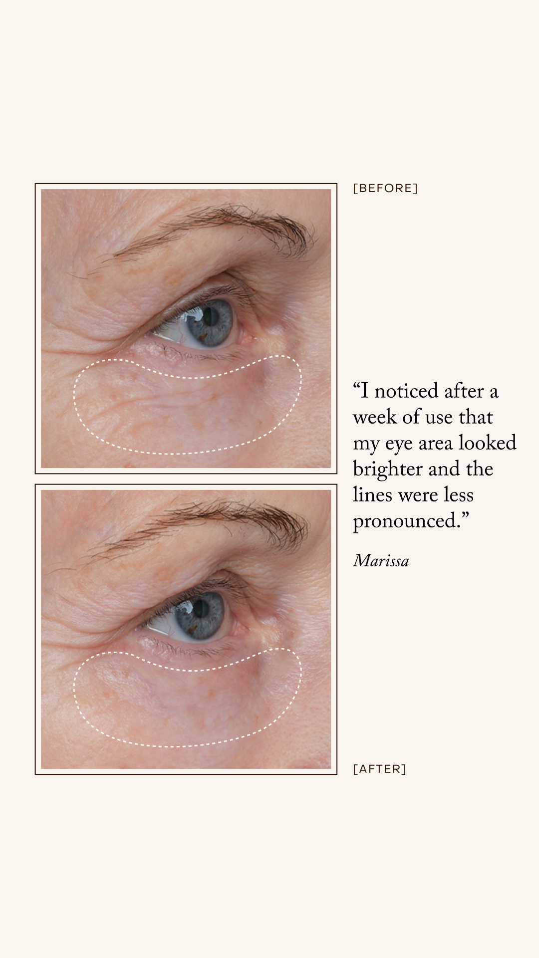 Pure Radiance Supreme Eye Cream