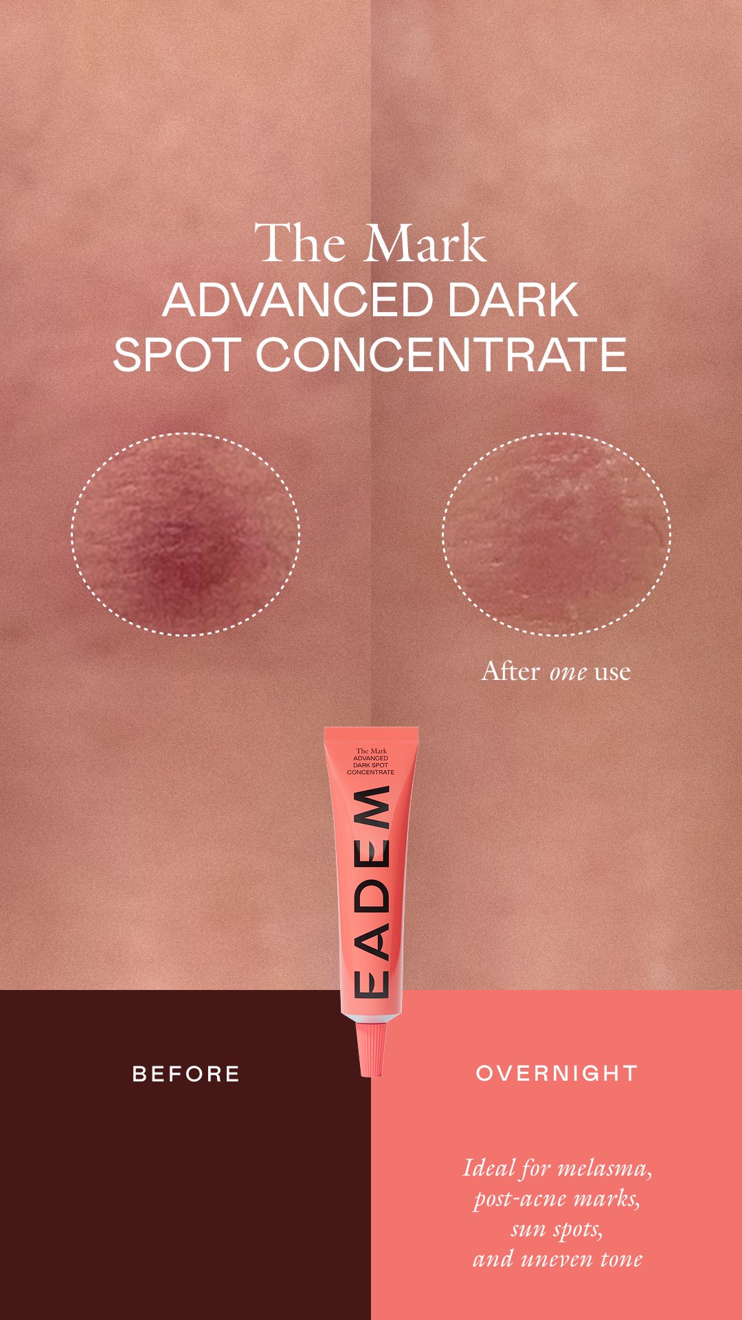 The before & after. 

Before: Visible dark spots and natural variation in tone. After: A more even-looking complexion, with dark spots appearing softened and skin looking clear and balanced. 

Comment MARK to be next in 