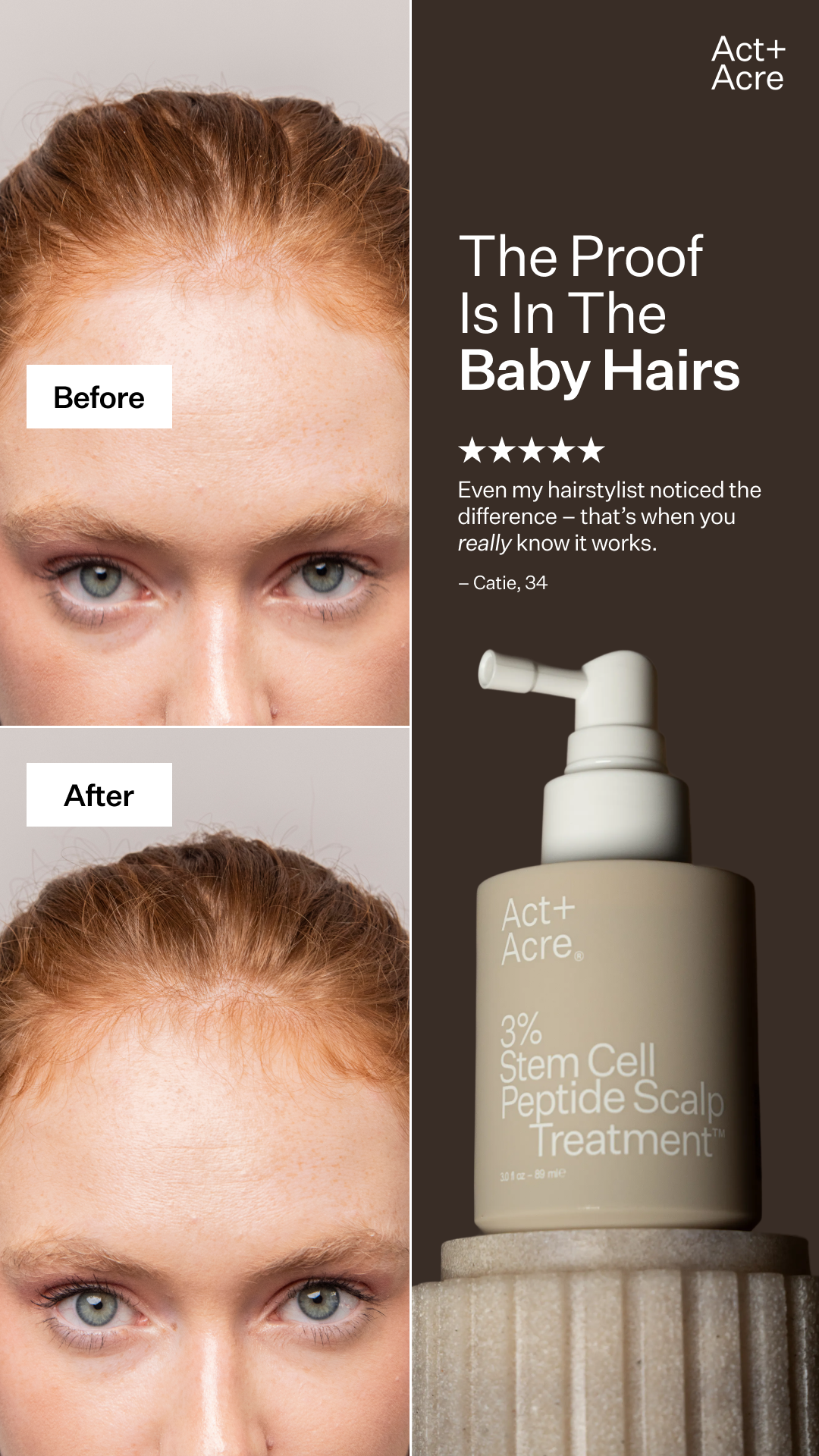 Your Fuller Hair Starter Kit