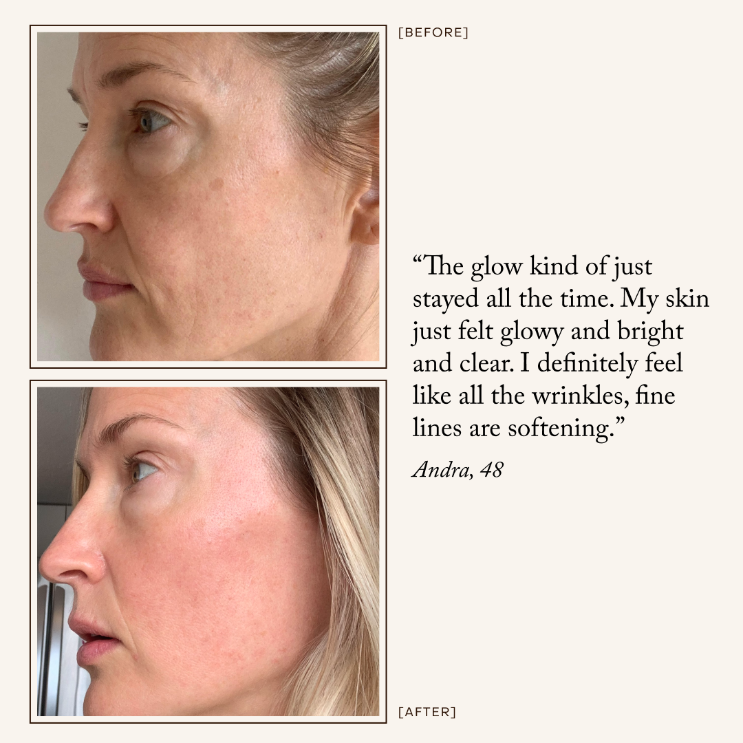Chebula Active Serum