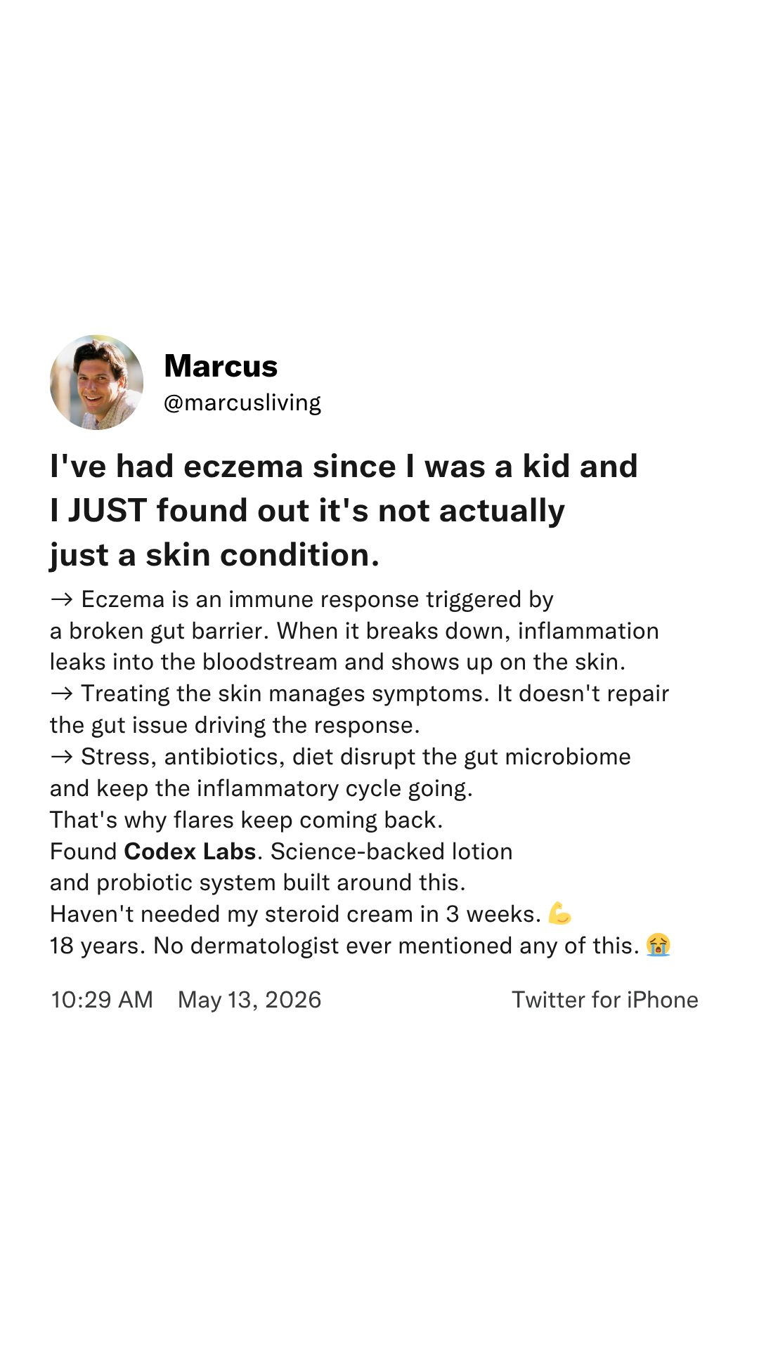 Finally, calm skin (for real this time).