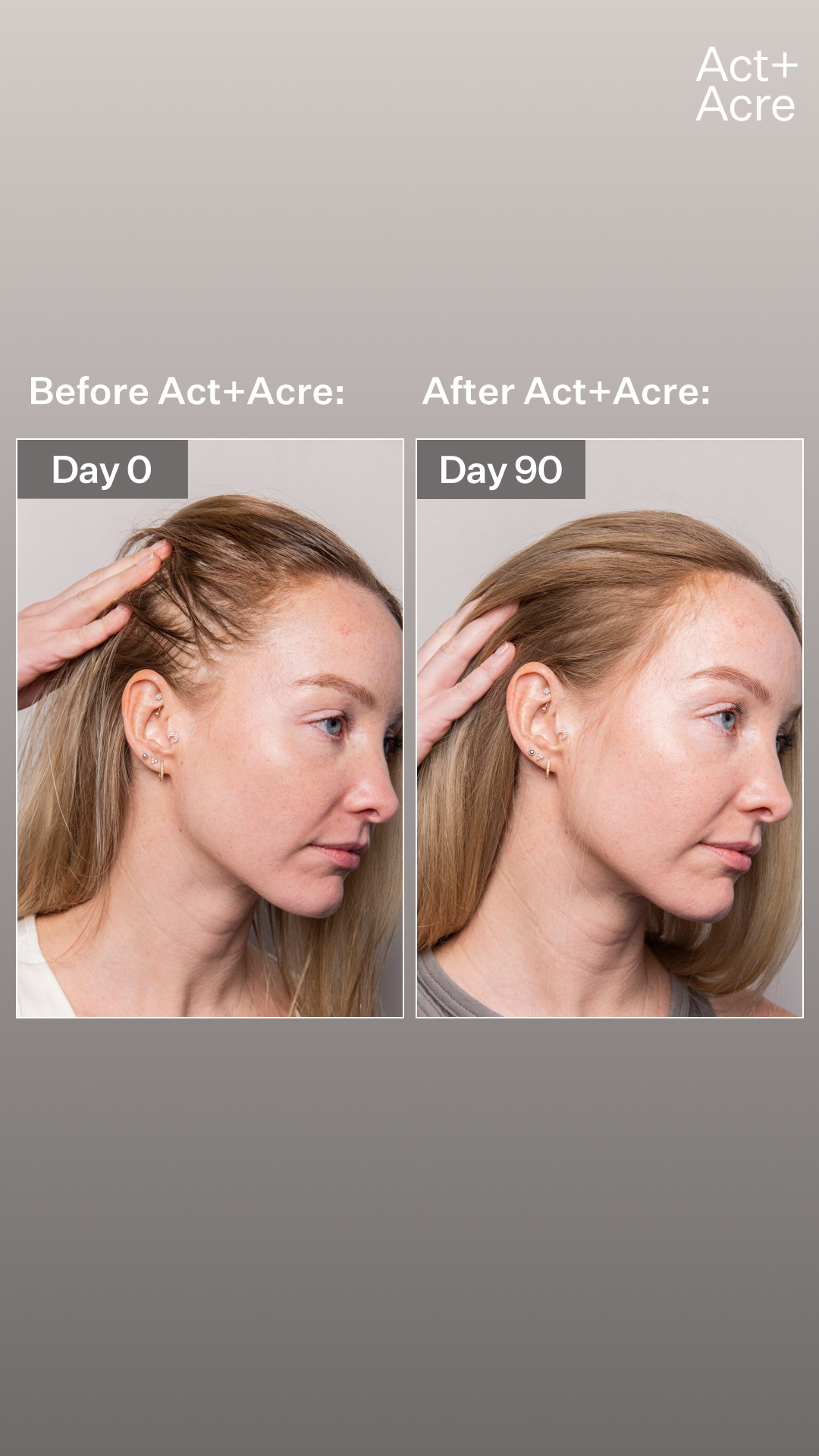 90% saw new hair growth in 6 weeks