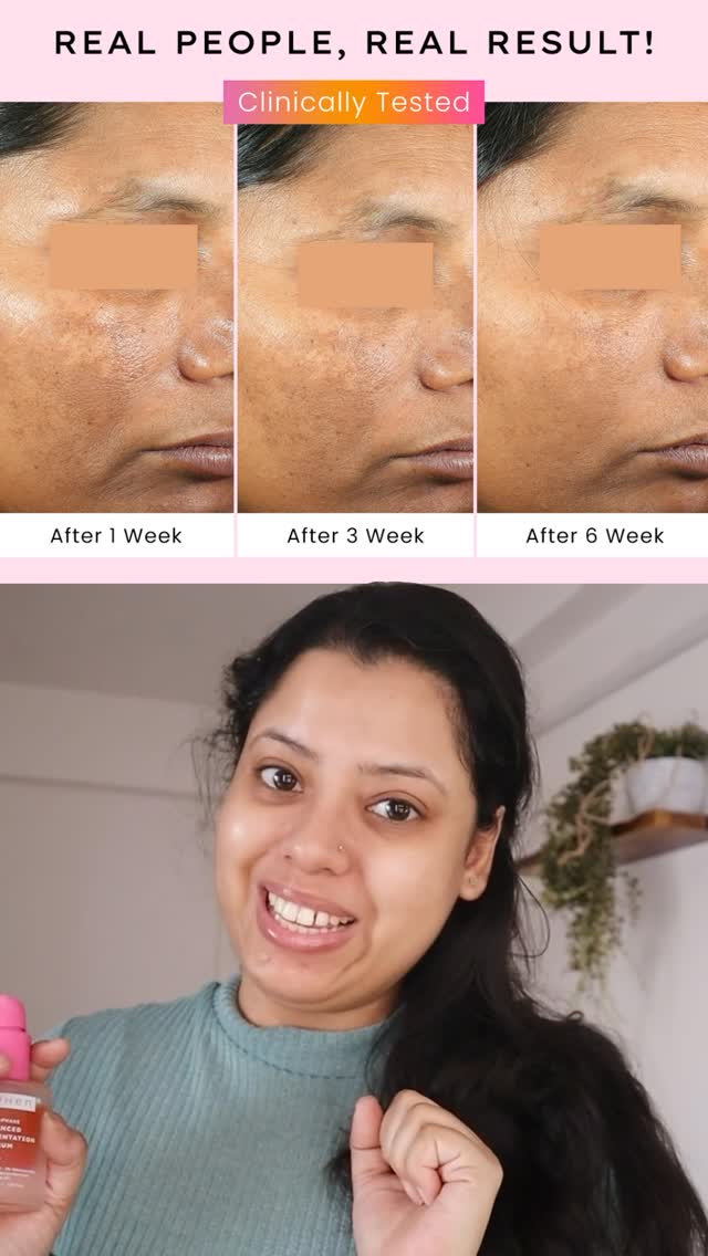 Comment PIGMENTATION for the link! 🔗

Omg guys, this truly works. That ingredient list is soo impressive + the texture is amazing. It feels like water and sinks into your skin, immediately hydrating it.

I’m still trying