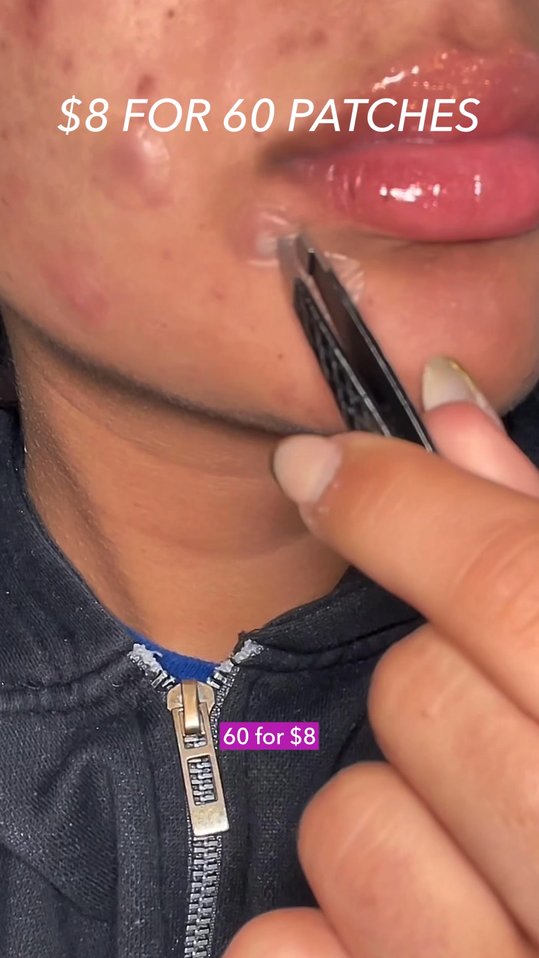 Invisible Patches, Real Results