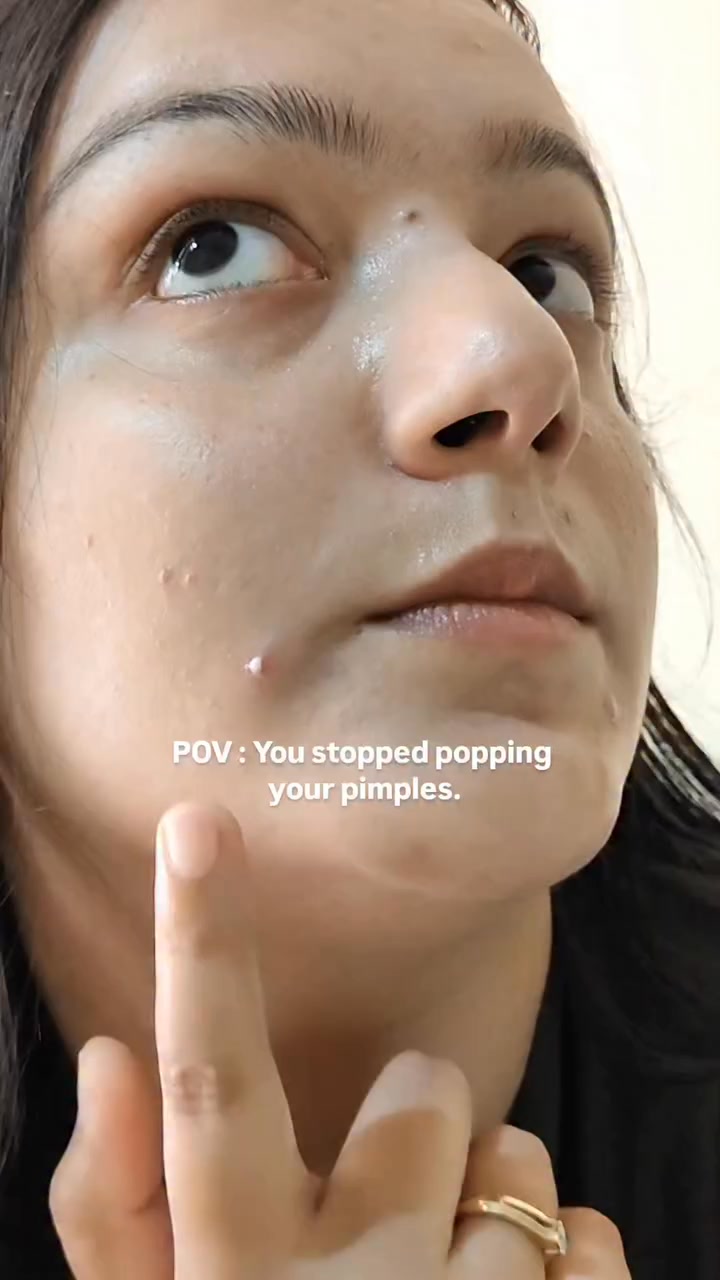 Zit Away Patches with Cica 🩹
