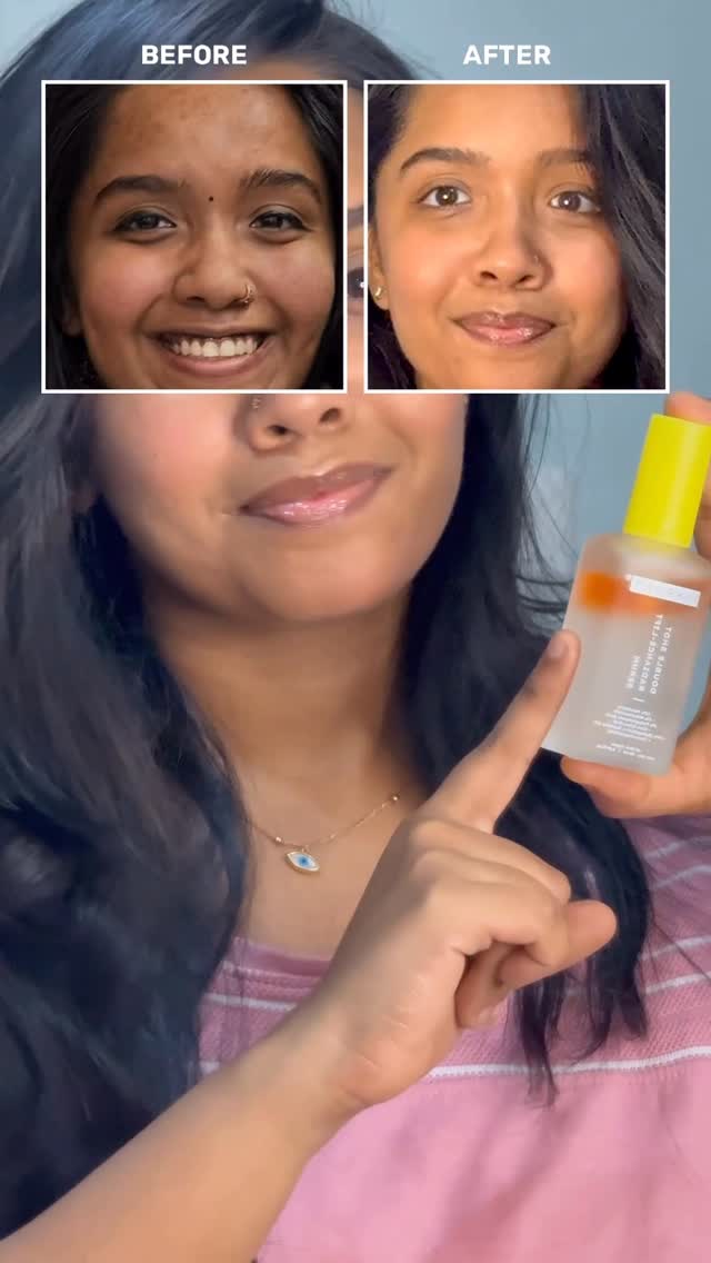 Comment for link🔗
That one serum for Pigmentation & darkspots 🥂

#fyp #contentcreator #serum #review