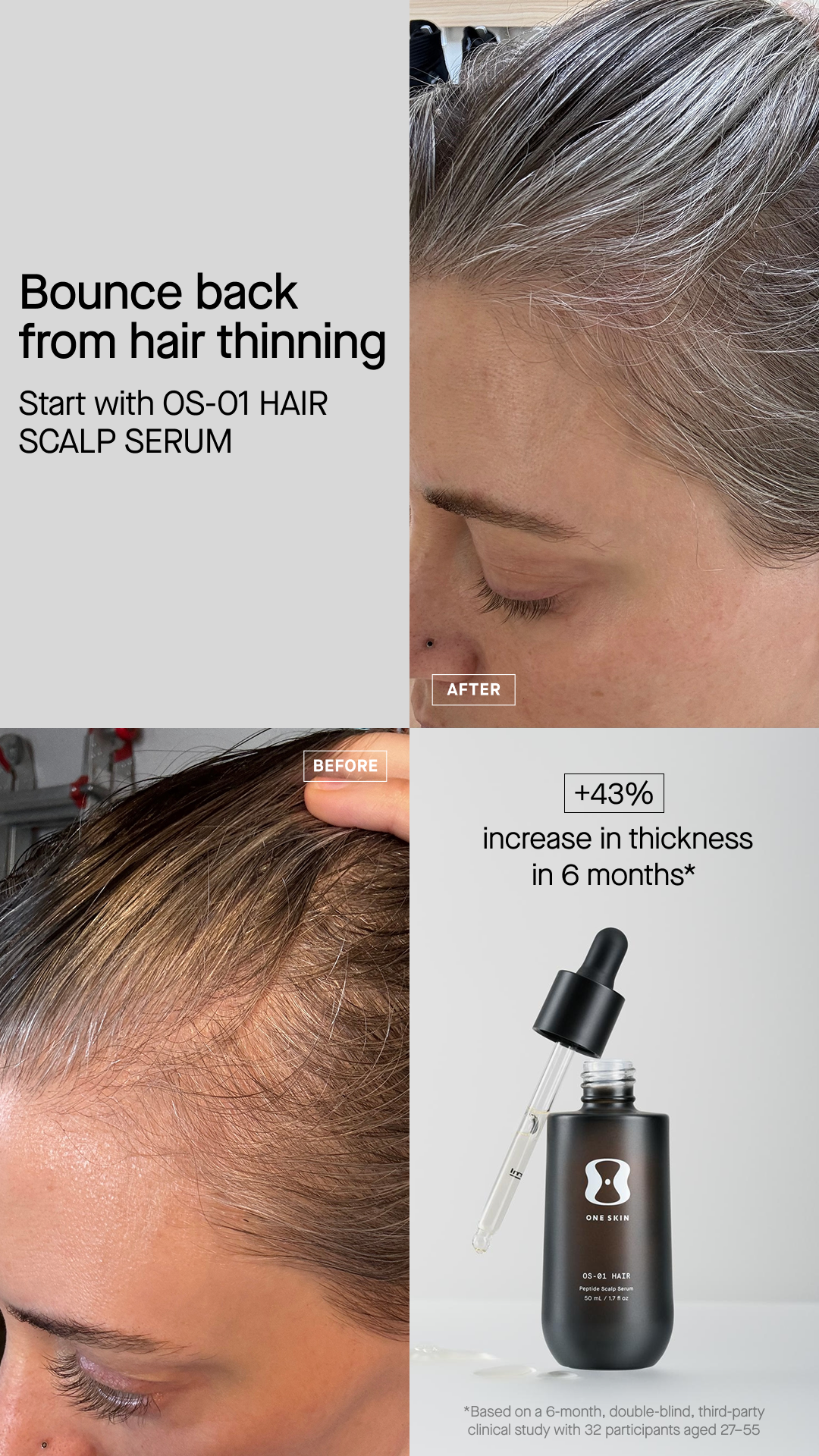 Meet OS-01 HAIR: Fuller, healthier-looking hair awaits