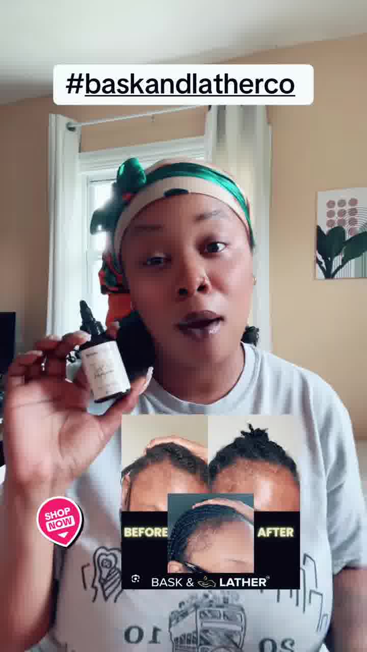 🔥Scalp Stimulator