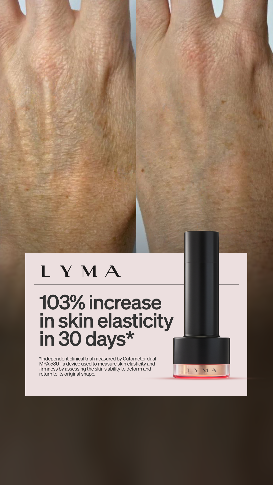 Cosmetic Surgery Results At-Home