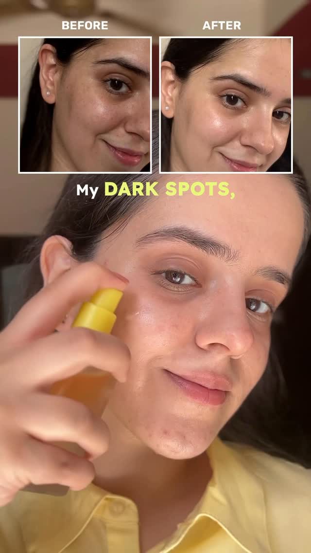 Comment for Link🔗

At the price of 1 serum, I got 2 in 1 bottle — such a unique innovation ✨ @letshyphen 
My dark spots & pigmentation reduced and my skin got brighter in just 4 weeks 💛

Try it for yourself, and thank me