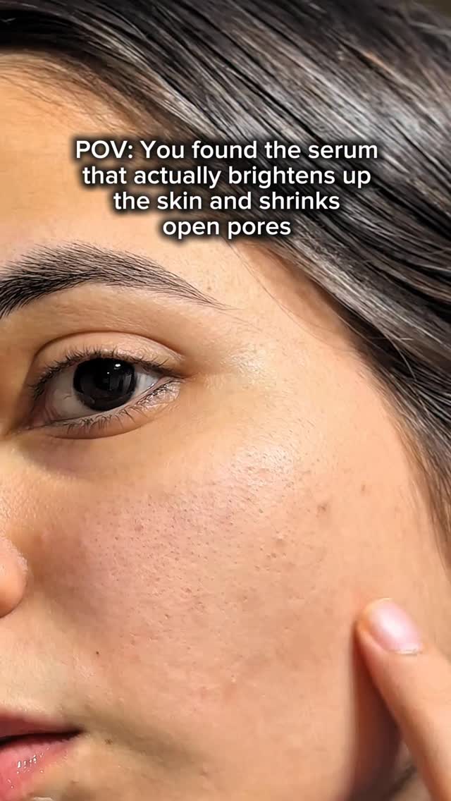 Comment for links! 🔗 Im in love with this niacinamide serum so gentle yet so effective on skin 💗

#niacinamide #niacinamideserum #foxtale #foxtaleskin #skincare #skinbrightening #openpores #fypage 

Niacinamide serum, op