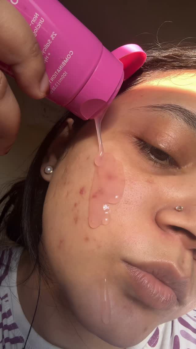 Comment for link 🔗 

Acne , face wash , oil control , excess oil , remove acne