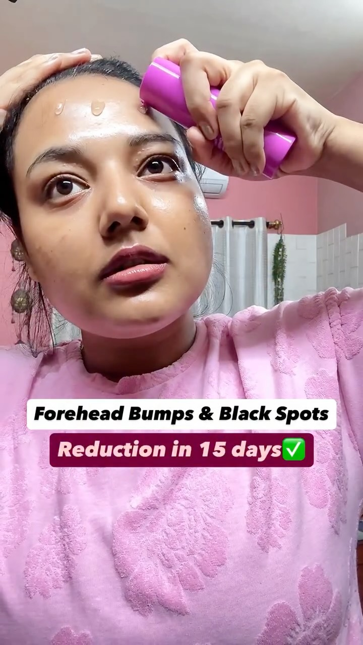 Comment for link 🔗 
Targeting acne, blemishes, and oiliness? Foxtale's 12% Niacinamide and Azelaic Acid serum is your solution. This potent, lightweight formula helps regulate oil production, minimize pores, and fade acn