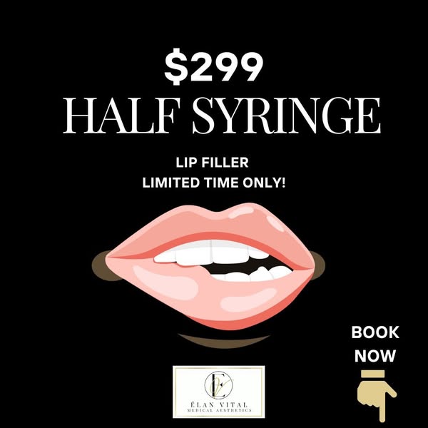 Lip Filler for Only $299 - Limited Time Only