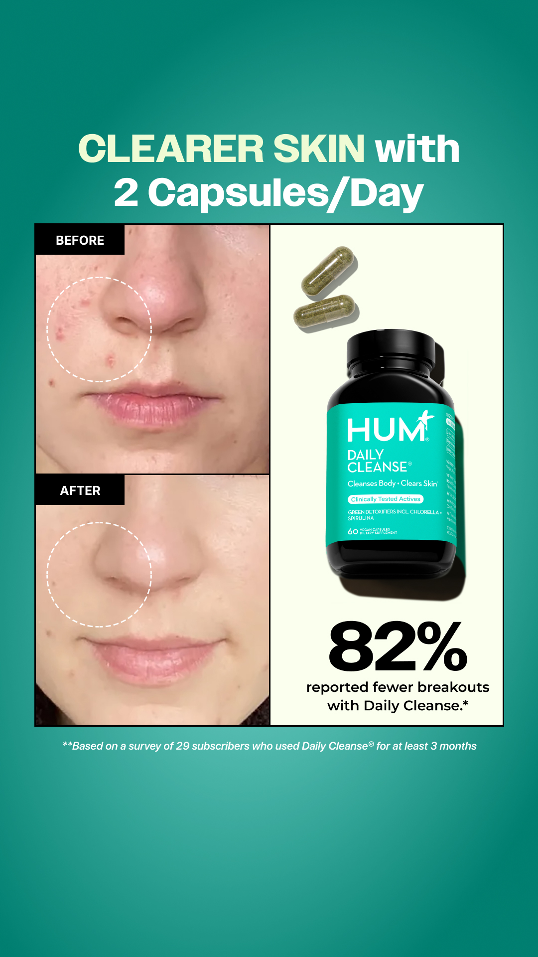 Daily Cleanse: The 2-in-1 Detox for Clear Skin

Daily Cleanse is a gentle, science-backed reset for your skin and your system. With 14 powerful detoxifiers, including chlorella, spirulina, and milk thistle, it supports y