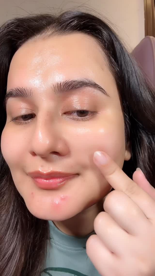 Agar aapko Dark spots, acne marks, uneven skin tone aur large pores ka solution ab ek hi bottle mein milega aur
woh hai ye Pilgrim ka 10% Niacinamide Serum.. Ye lightweight serum brighten kare, hydrate kare aur aapki ski
