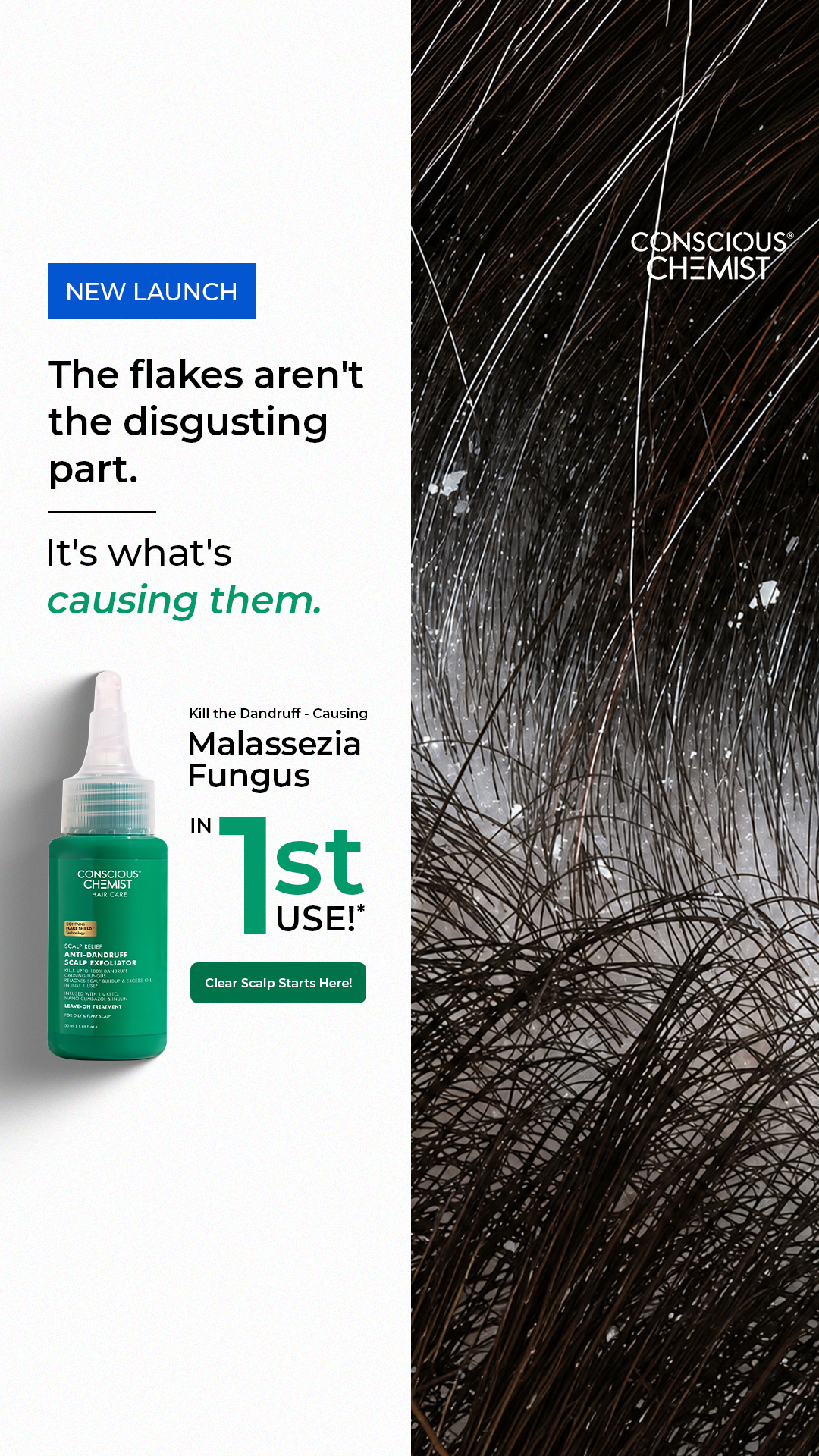 🛡️ Targets Dandruff At The Root