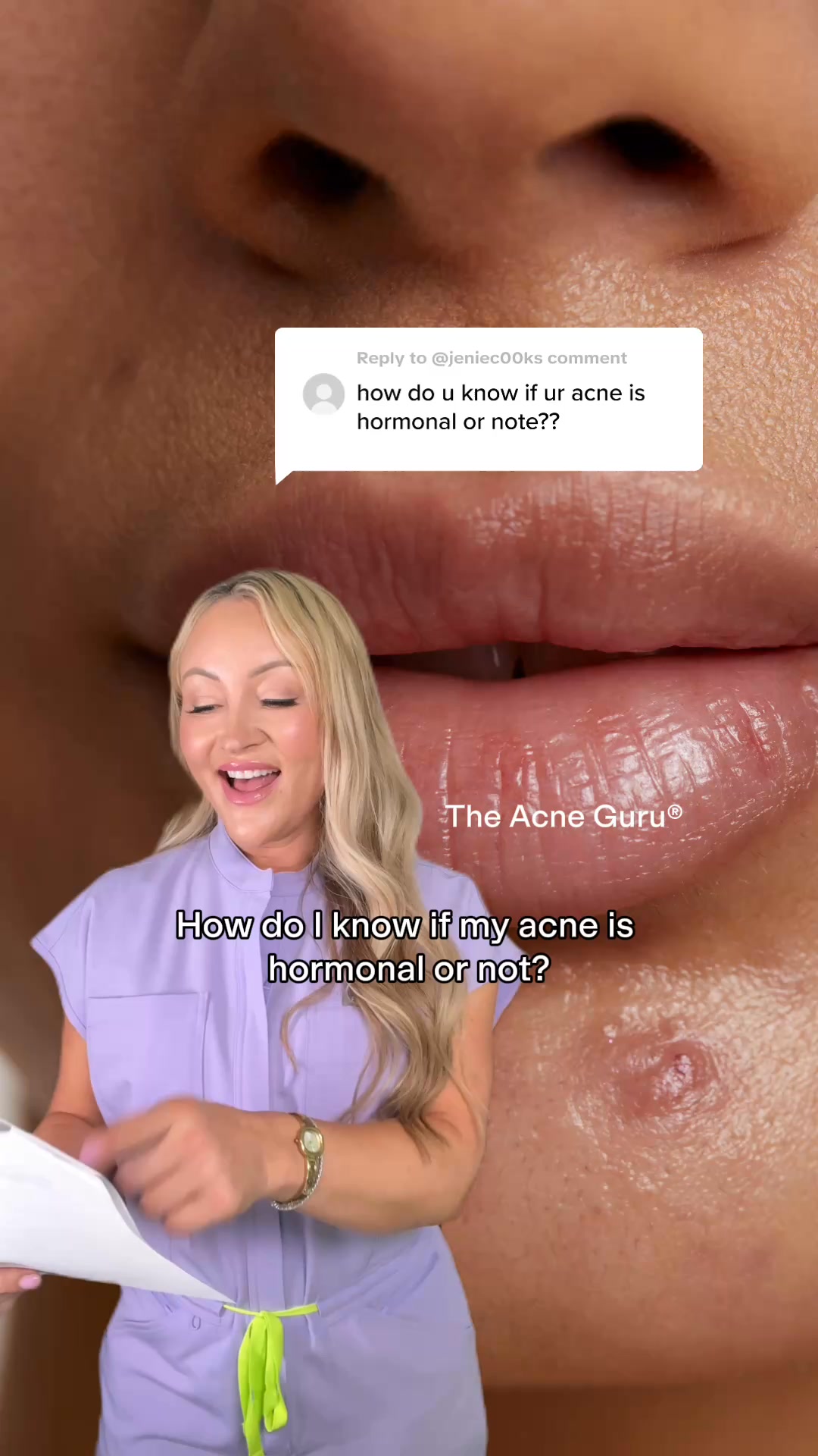 Uncover What’s Really Behind Your Breakouts