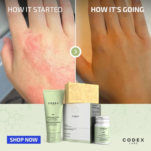 Say Goodbye to Flare-Ups