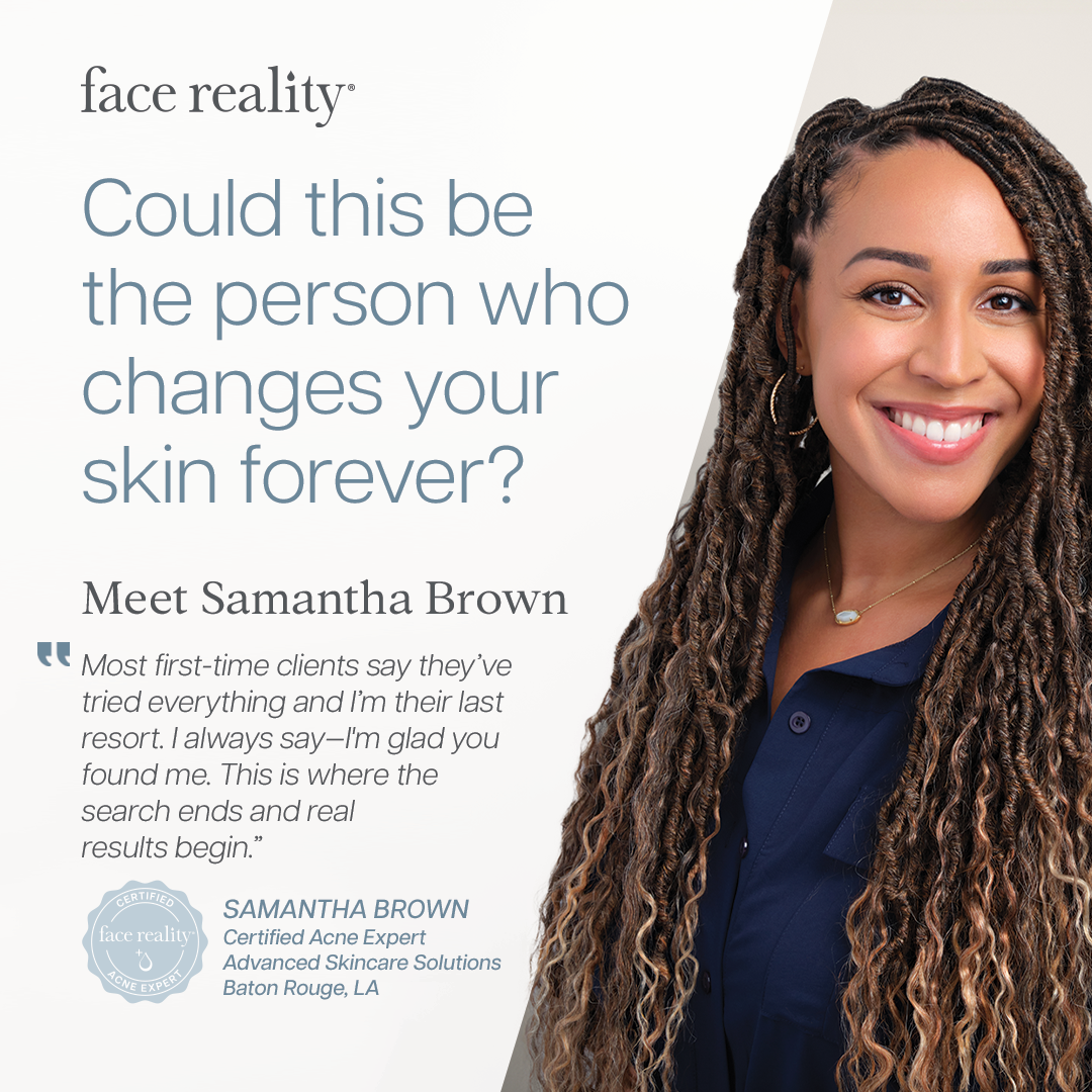 Find Your Acne Expert