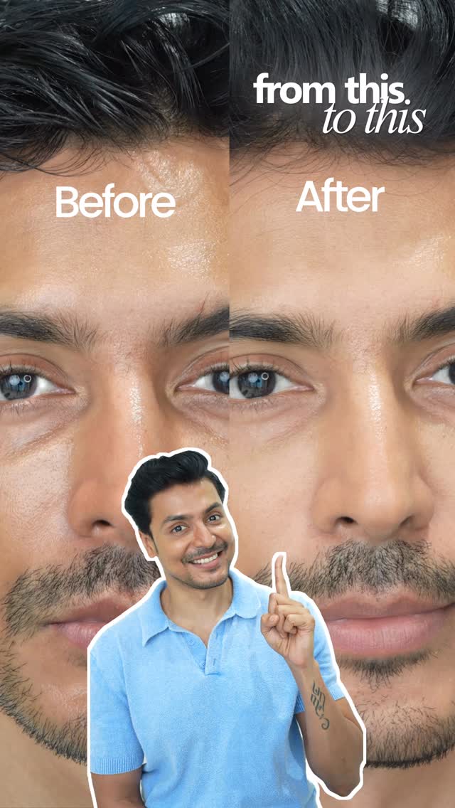 Oily skin doesn’t mean “skip moisturizer.”

It means finding one that hydrates without making your face feel like it has an extra greasy layer sitting on top.

I tested this with my skin hydration/oil meter too — some mo