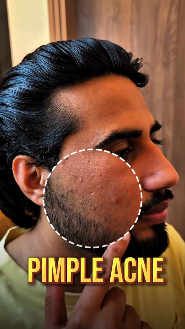 Comment ‘10’ for link 
10% Niacinamide (Vitamin B3) combined with 1% Zinc PCA work to fade acne marks and dark spots.
Niacinamide and Korean White Lotus work together to brighten the skin and enhance its overall radiance