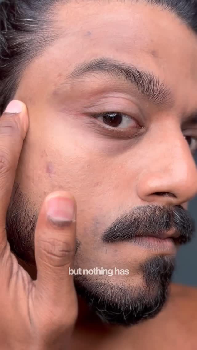 Tried so many dark spot serums and honestly, most of them just didn’t work for me. 🥲

Recently switched to Deconstruct’s upgraded Dark Spot Clearing Serum and the science behind it actually makes a lot of sense.

Let’s s