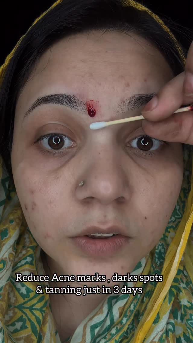 Comment for link🔗 

Agar aapko Dark Spots, acne marks, uneven skin tone aur large pores ka solution ab ek 
hi bottle mein milega aur woh hai ye @discover.pilgrim ka 10% Niacinamide Serum…Ye lightweight serum 
brighten ka