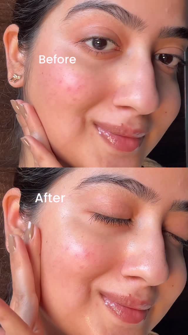Comment for the link 🔗 

(Niacinamide serum, skin clarifying serum, foxtale serum, foxtale products, clear skin serum, fade dark spots, pigmentation, bright skin, serum for glowing skin, serum review, azelaic acid skinca