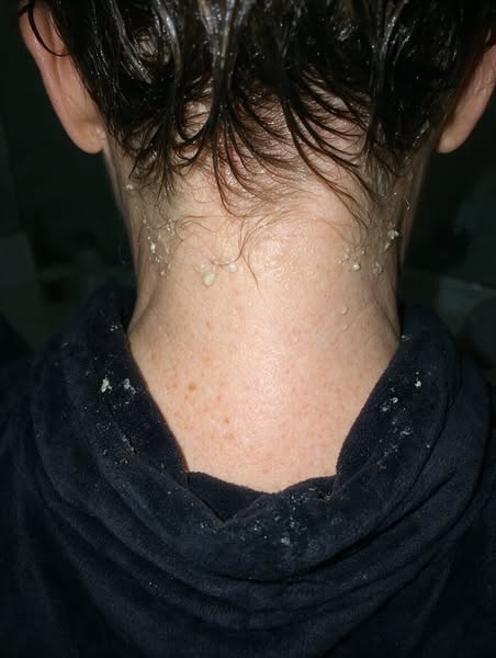 The itchy scalp you blame yourself for isn't your fault