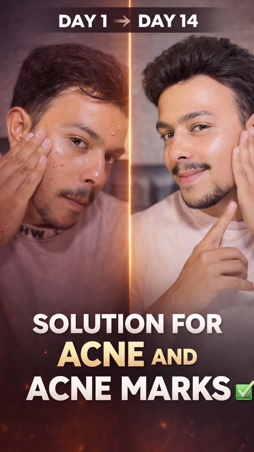 Bbohoot sahi Serum hai! Type ACNE and I will send it to you!😍 @foxtaleskin this one is amazing🙌 #skincare #skincareroutine #serum #acnemarks #acne