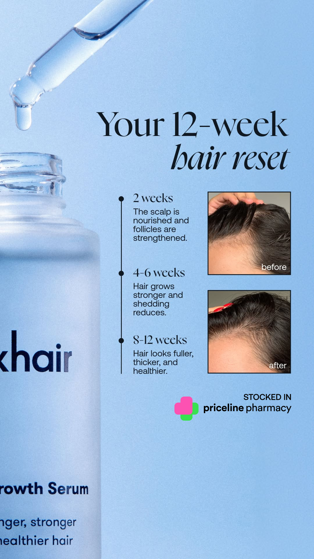 Stronger, Fuller-Looking Hair