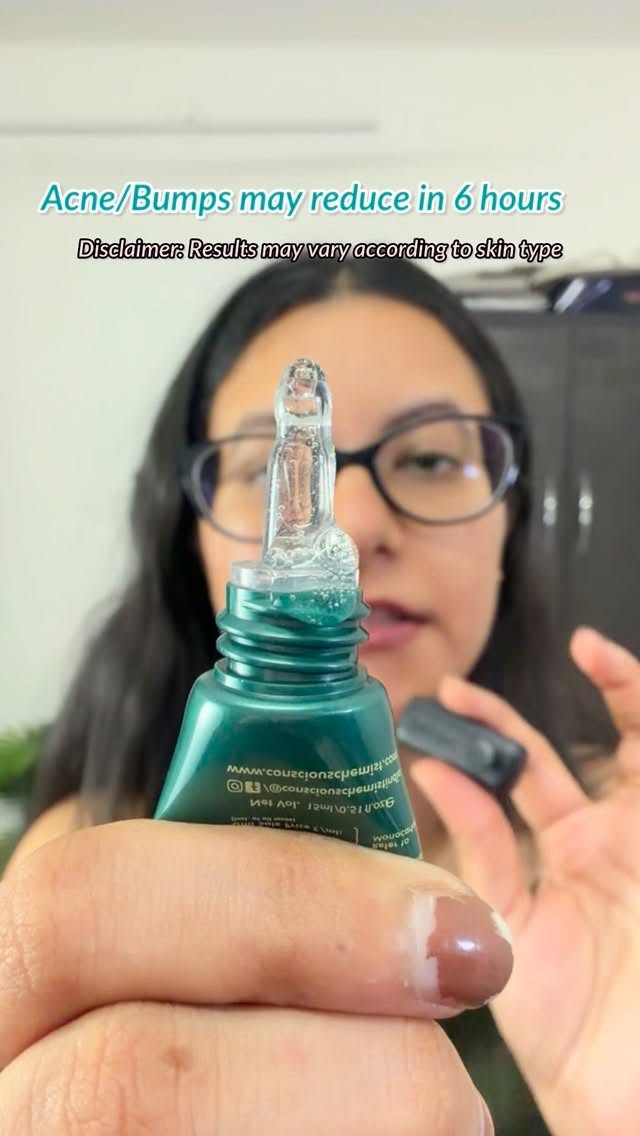 I have talks about this acne spot corrector gel previously as well and it works really well. My acne reduced a lot and I used it consistently 3 times in a week for about 2 months which made my skin clear and the bumps we