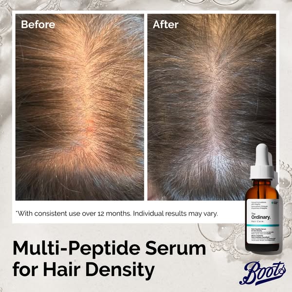 Hair Density Starts at the Root.