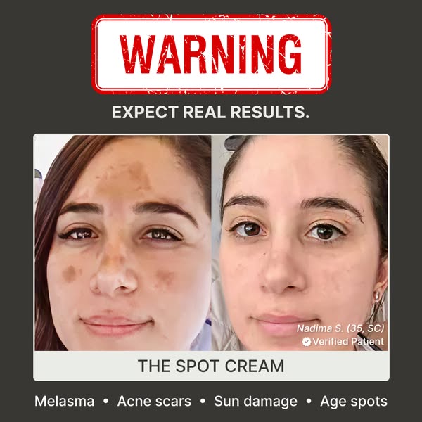 Fade Stubborn Melasma