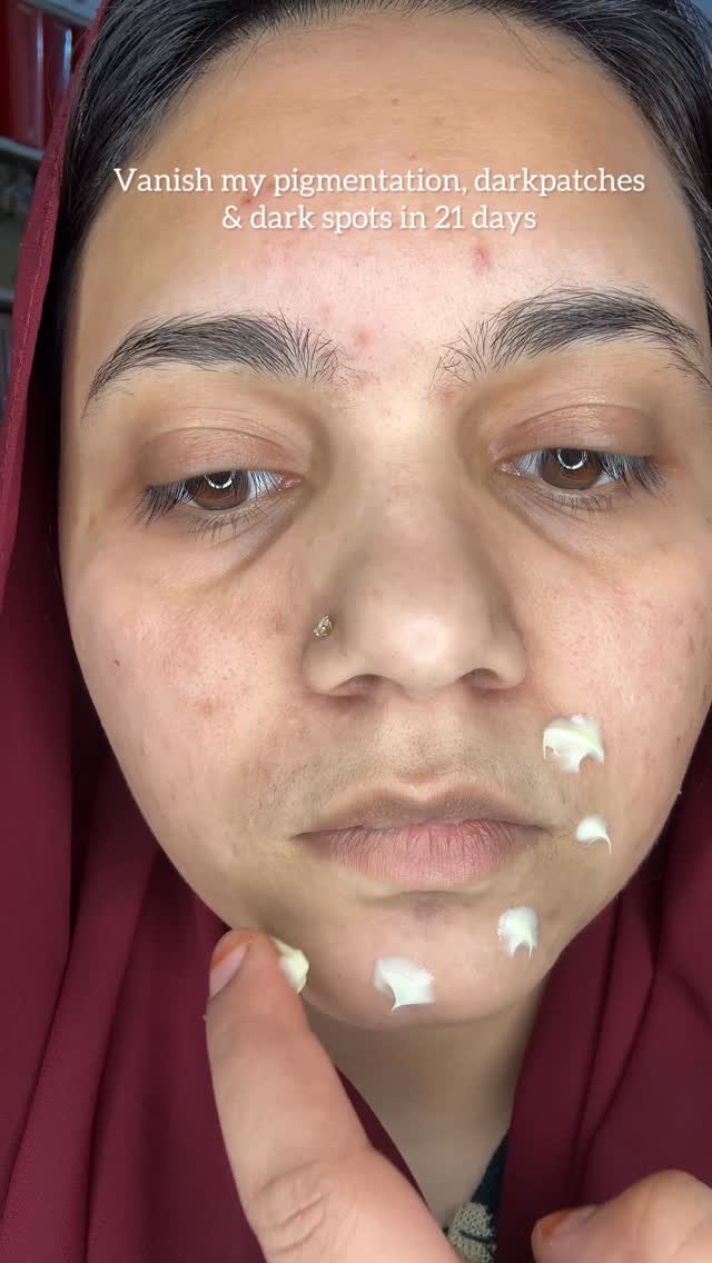 Comment for link 🔗 

Night cream , viral night cream , darkspots, pigmentation