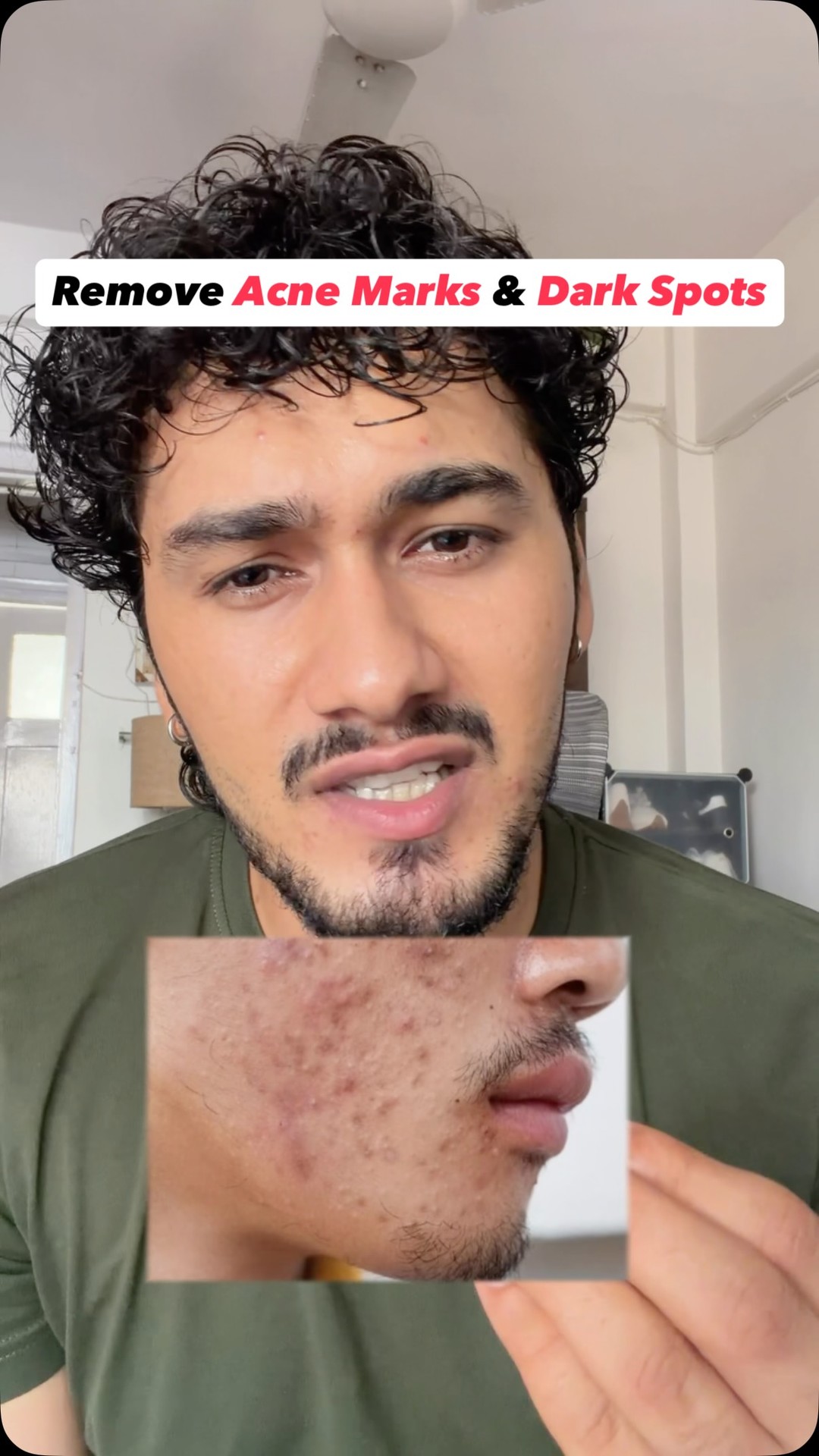 Comment “Serum” for 🔗✌️

Fade Dark Spots and get bright skin by using this Rule of 3:5
Loved this serum by @discover.pilgrim 

#skincare #oilyskin #acnemarks #darkspots #darkspotsolution