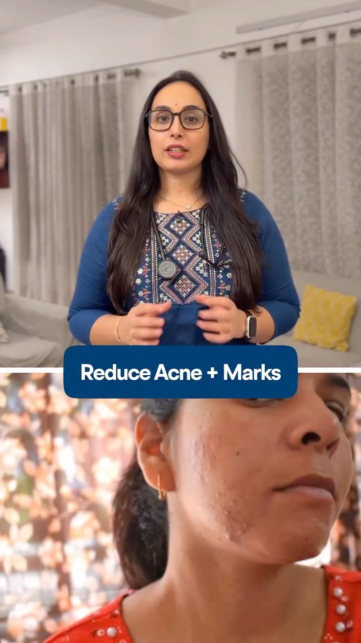 Comment : ACNE 

If you have oily and pimple prone skin, try deconstruct clearing serum which helps in reducing both pimple and mark as well.

[ niacinamide serum for oily skin, serum for oily skin, face serum for men, a