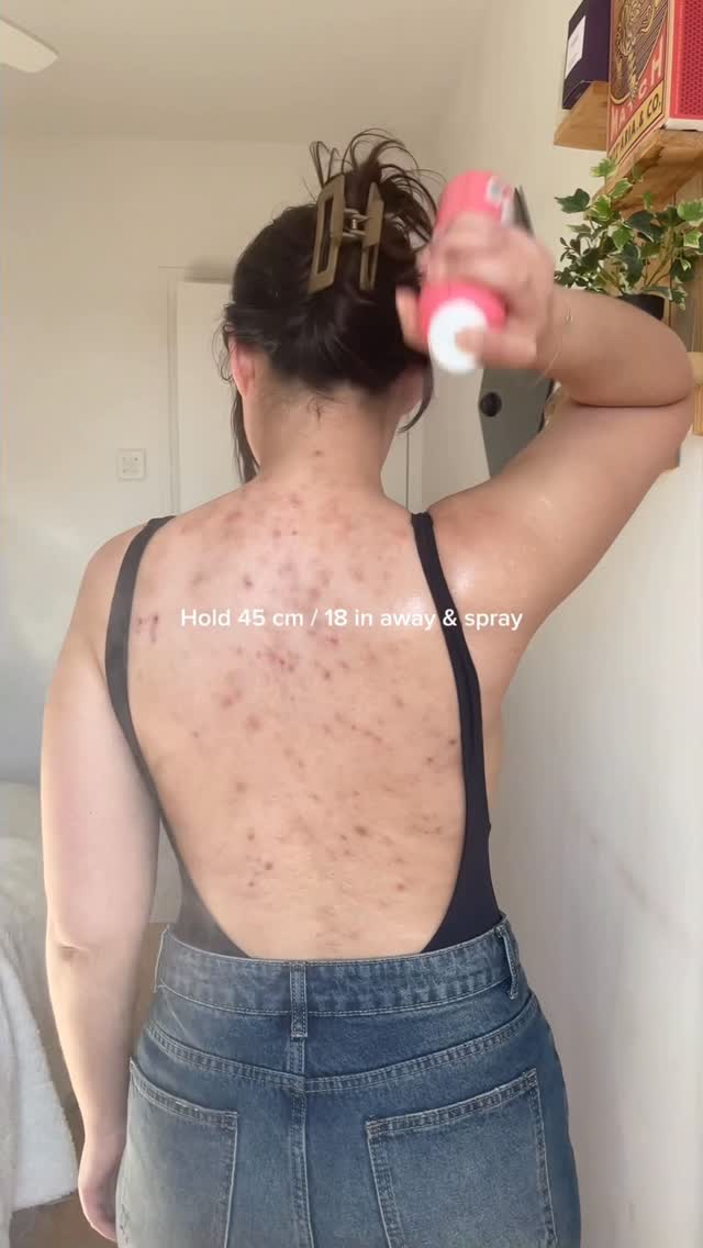 Got acne? You NEED to try this spray!
I’ve been using the Clarifying Bacne Spray from @clearstart for almost 3 years now! And it’s seriously my favorite🥰 It clears breakouts on my back and chest so easily ! 

I’m so happ