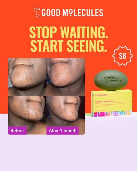 Save your skin from hyperpigmentation, blemish scars, redness, and acne damage that can worsen over time if left alone.

⭐⭐⭐⭐⭐ "This product literally saved my skin. I suffer from lupus and every time I flare, my skin br