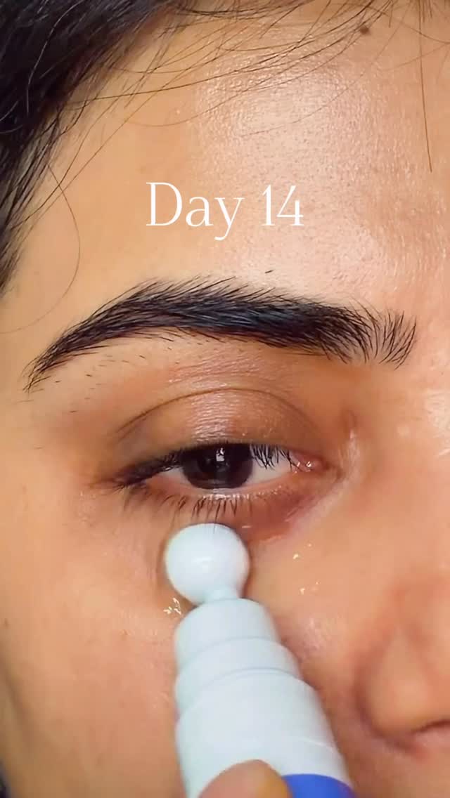 I didn’t realize how much my under-eyes were affecting my overall look until I started taking care of them consistently. 😮‍💨

The dark circles and puffiness used to make me look tired even on days I felt fine, and that’s