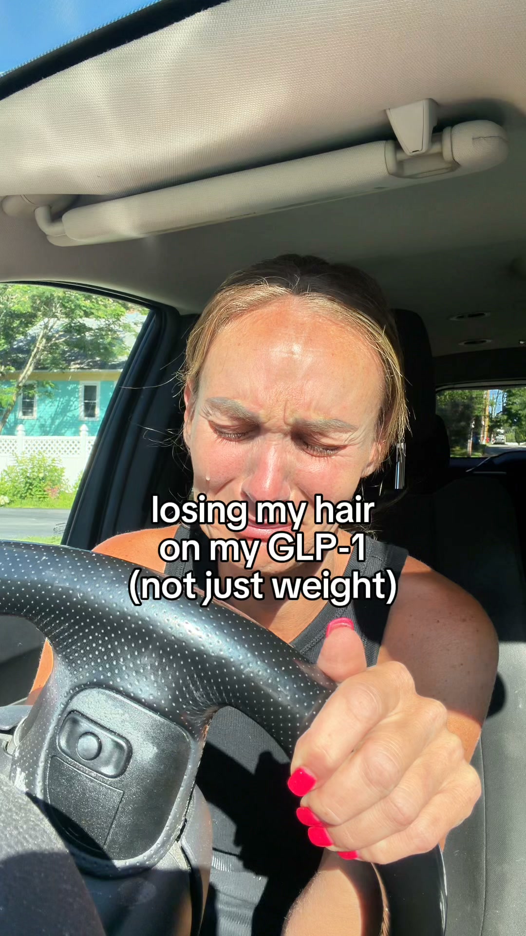Losing Hair on Ozempic? It's Not Stress, It's DHT